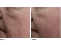 Dr. Dennis Gross Skincare DRx SpectraLite™ FaceWare Pro 9 Dr. Dennis Gross Skincare DRx SpectraLite™ FaceWare Pro -Classic Skin Care Product Store 02xa1d1l 201908291835367992