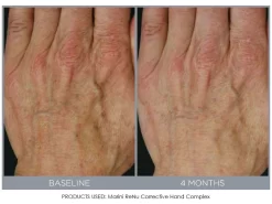 Jan Marini ReNu Corrective Hand Complex 7 Jan Marini ReNu Corrective Hand Complex -Classic Skin Care Product Store 0qa4j5fx 201809111634090177