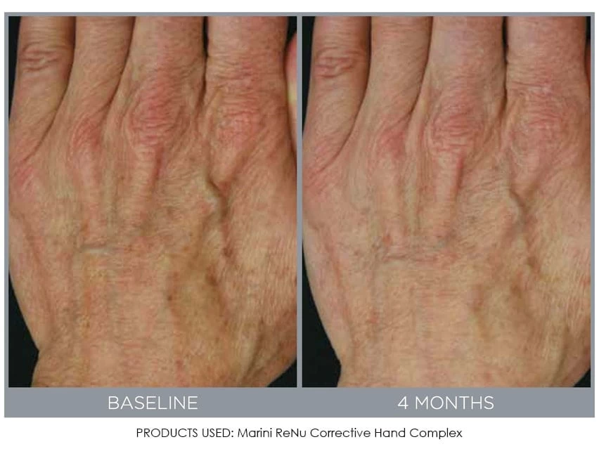 Jan Marini ReNu Corrective Hand Complex 3 Jan Marini ReNu Corrective Hand Complex - Image 3