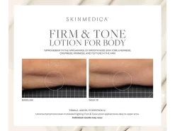 SkinMedica Firm & Tone Body Lotion -Classic Skin Care Product Store 134uhvit 202208182045383698