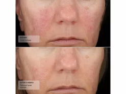 Senté Dermal Repair Cream -Classic Skin Care Product Store 1fbmo3ns 202305042045071577