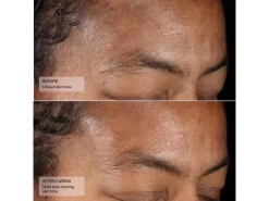 Senté Dermal Repair Cream -Classic Skin Care Product Store 2dv50jan 202305051334180477