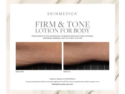 SkinMedica Firm & Tone Body Lotion -Classic Skin Care Product Store 3faqllj4 202208182047224121