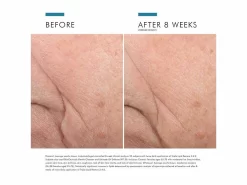 SkinCeuticals Triple Lipid Restore 2:4:2 Anti-Aging Cream -Classic Skin Care Product Store 3ir5vqlx 202207081924074022