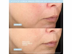 NuFACE TRINITY+ And Effective Lip & Eye Attachment -Classic Skin Care Product Store 3p1oooz3 202206221434201751