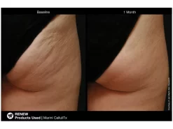 Jan Marini CelluliTx Cellulite Cream -Classic Skin Care Product Store 3ywk5owh 201806111728537712