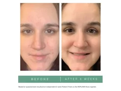 Replenix Gly-Sal 5-2 Clarifying Pads -Classic Skin Care Product Store 545n0tdb 202208101802555390