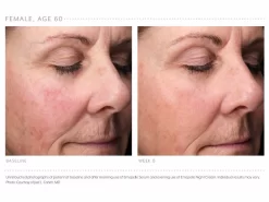 Emepelle Serum -Classic Skin Care Product Store 5klremri 202102161745558283