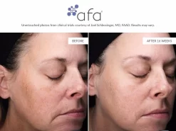 Afa Restorative Gel Plus -Classic Skin Care Product Store 5qpjhgfn 202107131942599486