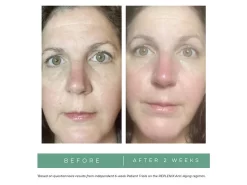 Replenix Age Restore Nighttime Therapy -Classic Skin Care Product Store auv3tzpd 202208101814427925