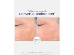 NEOSTRATA Skin Active Tri-Therapy Lifting Serum 8 NEOSTRATA Skin Active Tri-Therapy Lifting Serum -Classic Skin Care Product Store bi2pnica 202210071329091576