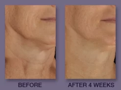 DefenAge 6-Week Perfection Neck Cream -Classic Skin Care Product Store bn4trdo0 202011052127436867