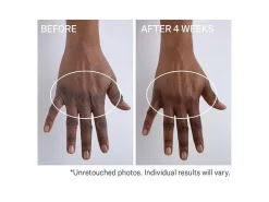 StriVectin Anti-Wrinkle Volumizing & Rejuvenating Hand Cream 6 StriVectin Anti-Wrinkle Volumizing & Rejuvenating Hand Cream -Classic Skin Care Product Store bnwjw1xa 202107012145146812