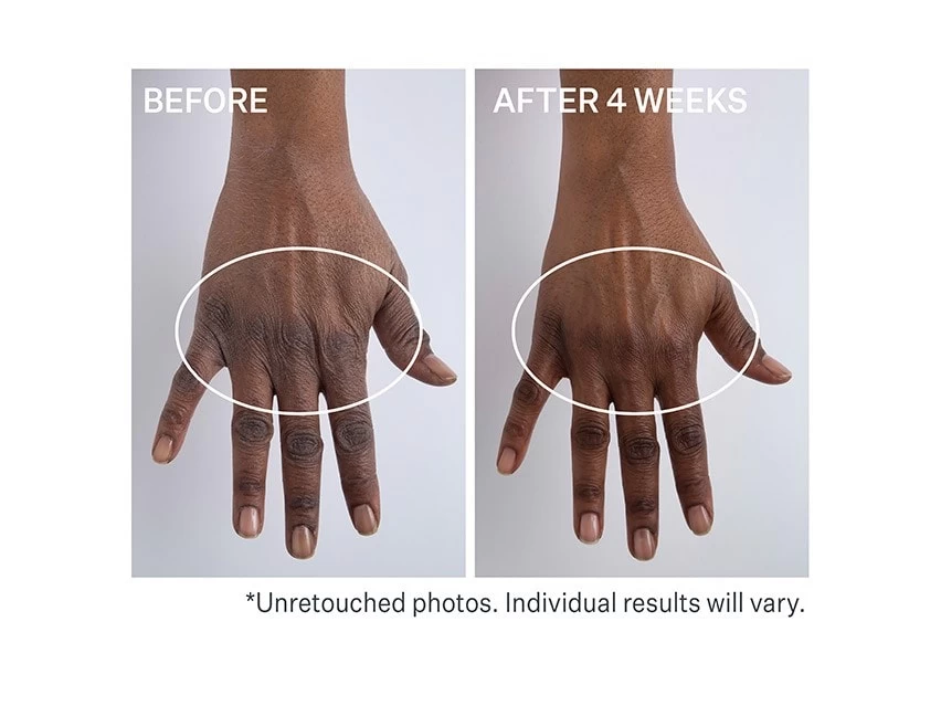 StriVectin Anti-Wrinkle Volumizing & Rejuvenating Hand Cream 3 StriVectin Anti-Wrinkle Volumizing & Rejuvenating Hand Cream - Image 3