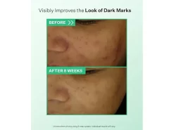 StriVectin Daily Brightening & Retexturizing Toner 8 StriVectin Daily Brightening & Retexturizing Toner -Classic Skin Care Product Store bpzkk2jp 202303221448206985