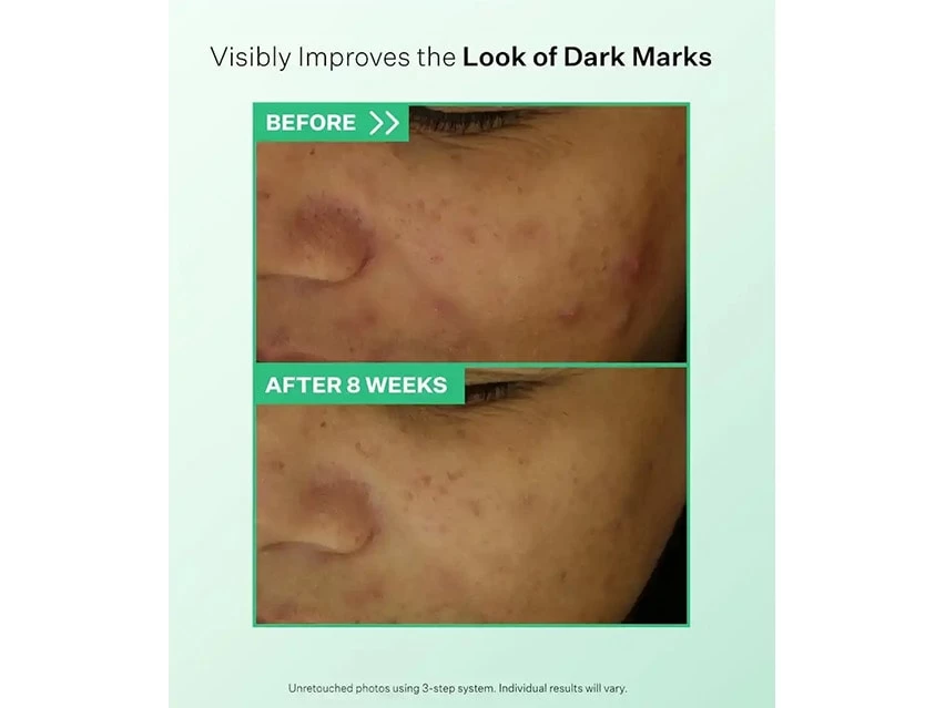 StriVectin Daily Brightening & Retexturizing Toner 3 StriVectin Daily Brightening & Retexturizing Toner - Image 3