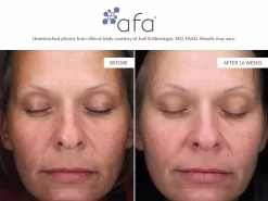 Afa Restorative Gel Plus -Classic Skin Care Product Store buq5x2y0 202107131911366406