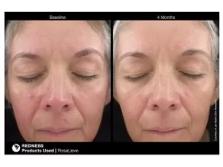 Jan Marini RosaLieve Redness Reducing Complex -Classic Skin Care Product Store ccktym4f 201803121531138163