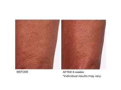 NassifMD® Crepe Inhibitor Triple Action Body Butter -Classic Skin Care Product Store dbgmas0j 202009221703599309