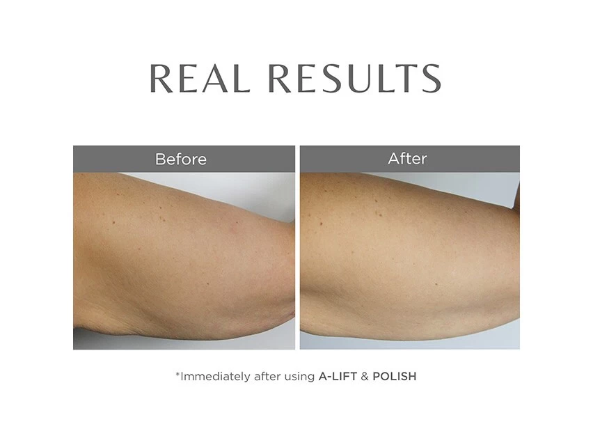 COSMEDIX A-Lift Overnight Vitamin A Body Treatment 4 COSMEDIX A-Lift Overnight Vitamin A Body Treatment - Image 4