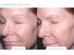 LovelySkin LUXE Advanced Retinol Serum -Classic Skin Care Product Store dni3ybdq 202111302023262993