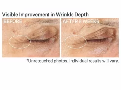 StriVectin Advanced Retinol Multi-Correct Eye Cream 13 StriVectin Advanced Retinol Multi-Correct Eye Cream -Classic Skin Care Product Store dnjo0esb 202210261743522169