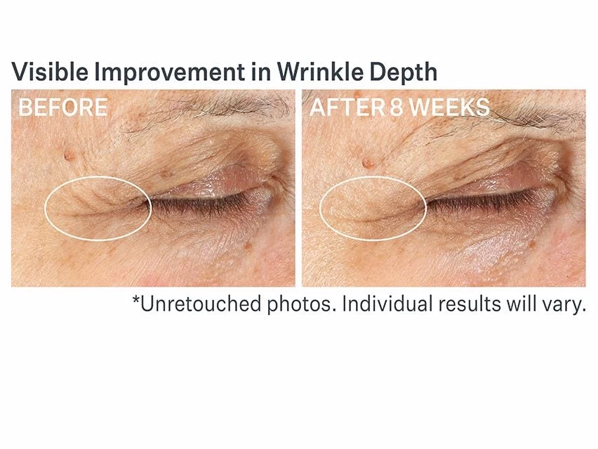 StriVectin Advanced Retinol Multi-Correct Eye Cream 6 StriVectin Advanced Retinol Multi-Correct Eye Cream - Image 6