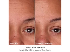 Dr. Dennis Gross Skincare DermInfusions Fill + Repair Serum -Classic Skin Care Product Store eopu3vwz 202303231529116980