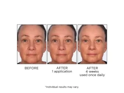 NassifMD® Daily Revitalizing Serum 11 NassifMD® Daily Revitalizing Serum -Classic Skin Care Product Store fafwdpqp 202009221849073182