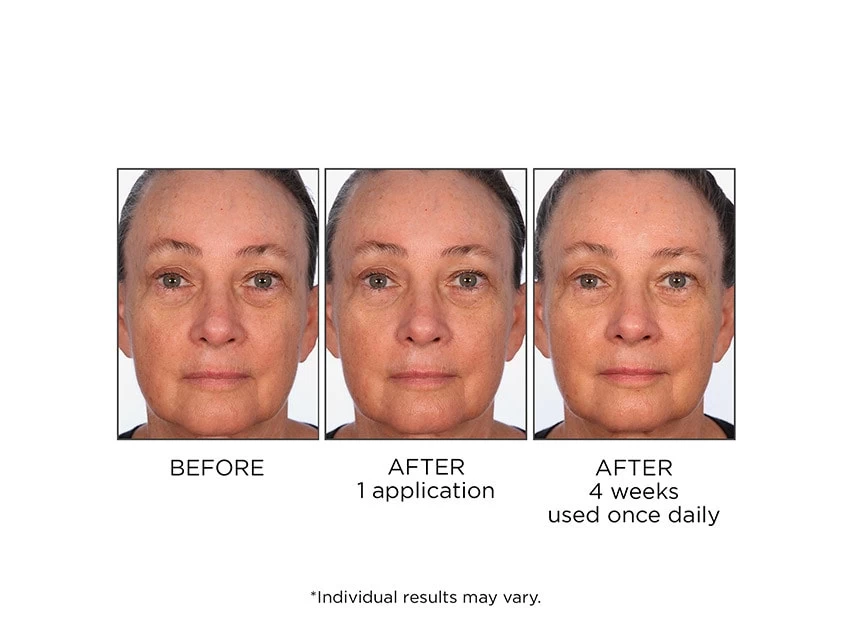 NassifMD® Daily Revitalizing Serum 6 NassifMD® Daily Revitalizing Serum - Image 6