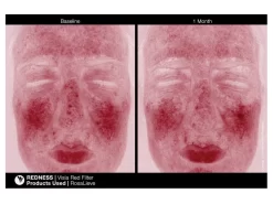 Jan Marini RosaLieve Redness Reducing Complex -Classic Skin Care Product Store fi5eznbv 201803121534026083