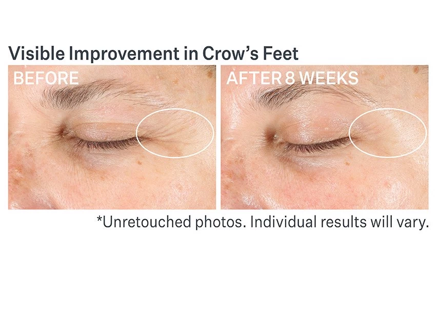 StriVectin Advanced Retinol Multi-Correct Eye Cream 5 StriVectin Advanced Retinol Multi-Correct Eye Cream - Image 5