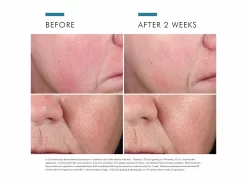 SkinCeuticals Phyto Corrective Essence Mist -Classic Skin Care Product Store gkax3ji1 202207131808259544