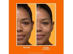 Peter Thomas Roth Potent-C Brightening Vitamin C Moisturizer 10 Peter Thomas Roth Potent-C Brightening Vitamin C Moisturizer -Classic Skin Care Product Store h0gaugn4 202304211649226682