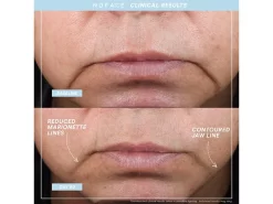 NuFACE TRINITY+ And Effective Lip & Eye Attachment -Classic Skin Care Product Store h0pgpasv 202206221450104894