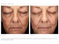 Emepelle Serum -Classic Skin Care Product Store h3veawh1 202102161751202271