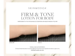 SkinMedica Firm & Tone Body Lotion -Classic Skin Care Product Store hchyvxpm 202208182044011536
