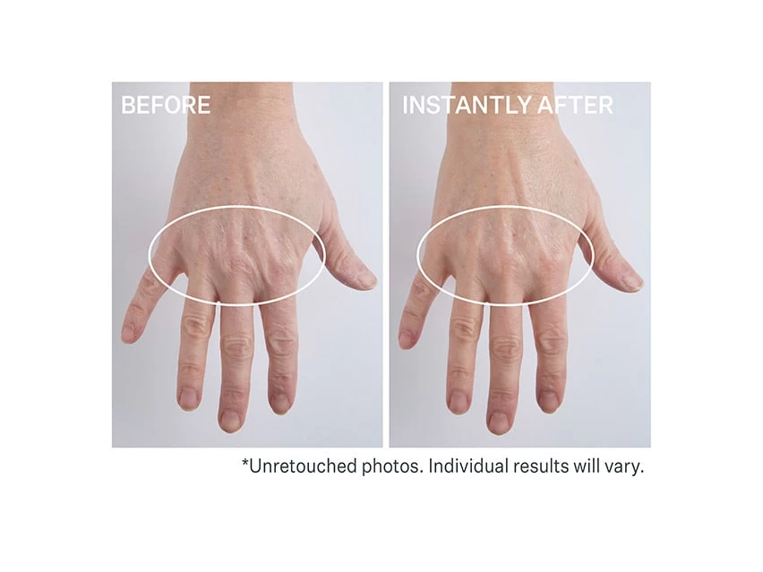 StriVectin Anti-Wrinkle Volumizing & Rejuvenating Hand Cream 2 StriVectin Anti-Wrinkle Volumizing & Rejuvenating Hand Cream - Image 2