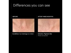 PCA SKIN Pigment Cleansing Face & Body Bar 13 PCA SKIN Pigment Cleansing Face & Body Bar -Classic Skin Care Product Store hpsttb0p 202205261701259879