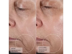 Senté Dermal Contour Pressed Serum -Classic Skin Care Product Store hqrdmsbz 202305051458170259