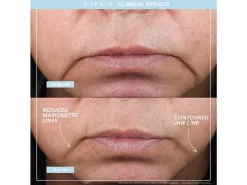 NuFACE TRINITY+ Starter Kit -Classic Skin Care Product Store ijeq11fh 202206211813461064