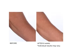 NassifMD® Crepe Inhibitor Triple Action Body Butter -Classic Skin Care Product Store ipwrqkbb 202009221702274320