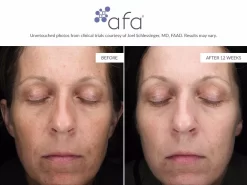 Afa Restorative Gel Max -Classic Skin Care Product Store itv0cuor 202107131858104917