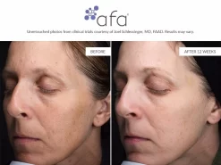 Afa Restorative Gel Max -Classic Skin Care Product Store iukve1iq 202107131859438228