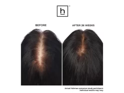 HairMax LaserBand 41 ComfortFlex Hair Growth Device -Classic Skin Care Product Store ivydbcp0 202211091916466226