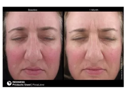 Jan Marini RosaLieve Redness Reducing Complex -Classic Skin Care Product Store jjk2n2xt 201803121530447379