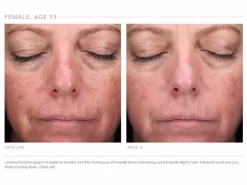 Emepelle Serum -Classic Skin Care Product Store jxe0zb15 202102161745166119