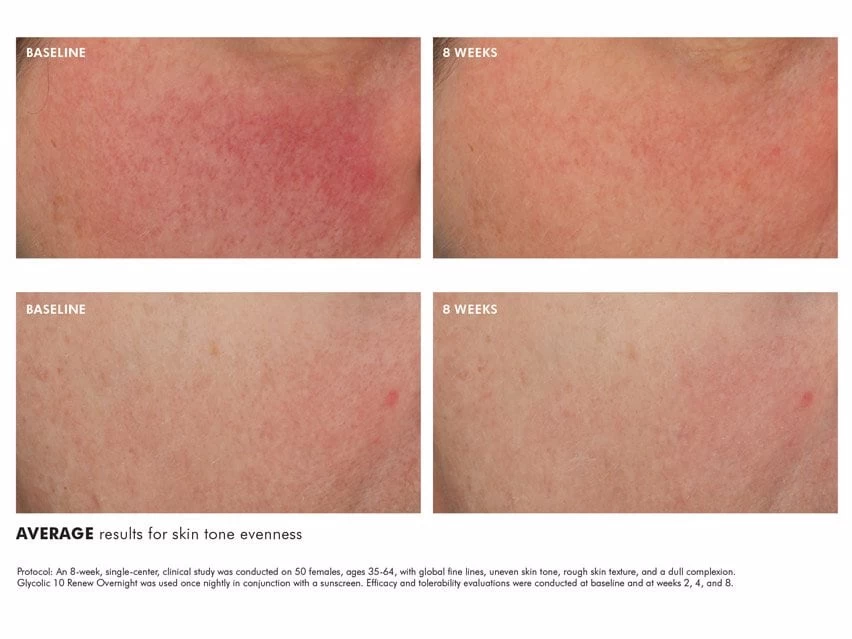 SkinCeuticals Glycolic 10 Renew Overnight Exfoliating Treatment 3 SkinCeuticals Glycolic 10 Renew Overnight Exfoliating Treatment - Image 3