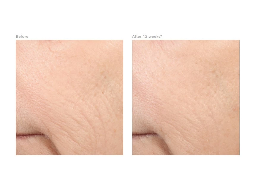 Revision Skincare Retinol Complete 0.5 2 Revision Skincare Retinol Complete 0.5 - Image 2