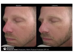 Jan Marini RosaLieve Redness Reducing Complex -Classic Skin Care Product Store lyswkorq 201803121532113647